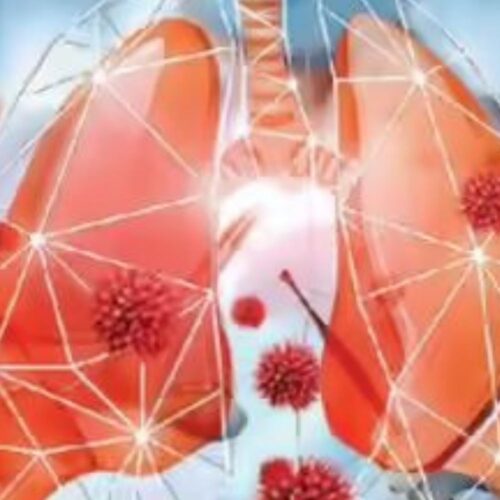 Covid’s unpleasant surprise: Sore gallbladder