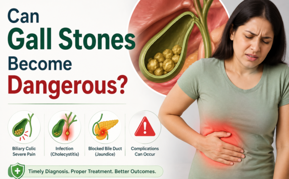 gallbladder stones treatment in delhi