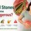 gallbladder stones treatment in delhi