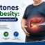 Gallstones and Obesity: Is There a Connection?