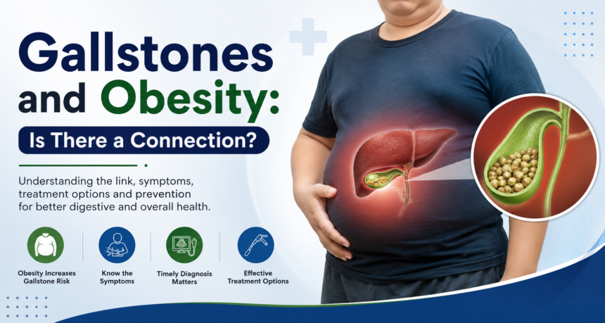 Gallstones and Obesity: Is There a Connection?